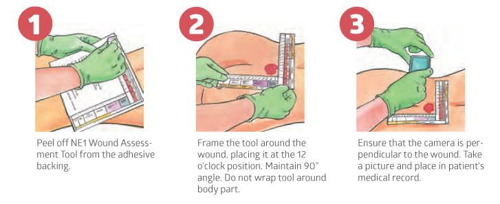 wound-assessment